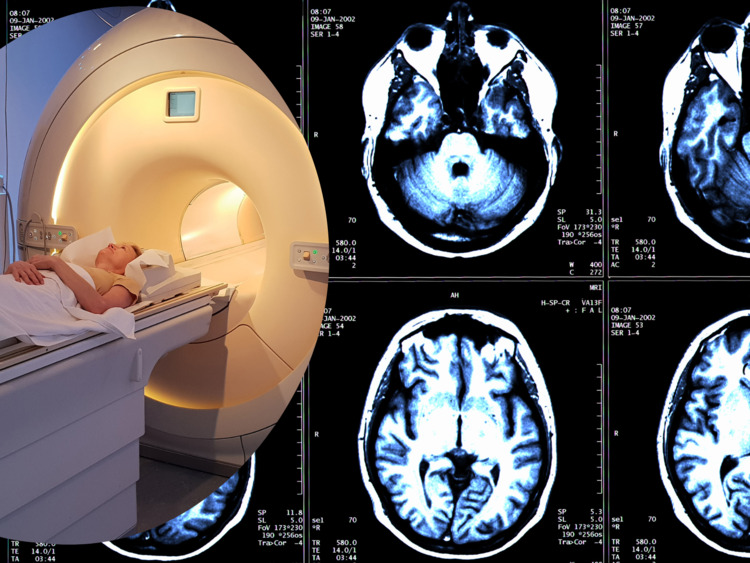 Brain Injury scan in North Carolina