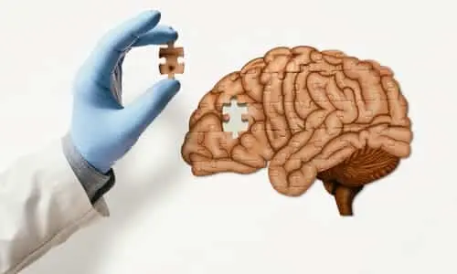 A surgeon's gloved hand against a white background, holding up the last puzzle piece for a jigsaw puzzle of a brain.