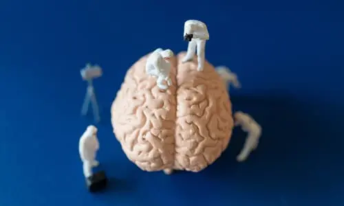 Several miniature people posed around and on a model brain as though studying it.